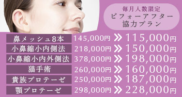 毎月人数限定 ビフォーアフター協力プラン。鼻メッシュ8本145,000円→115,000円小鼻縮小内側法218,000円→150,000円小鼻縮小内外側法378,000円→198,000円猫手術260,000円→160,000円貴族プロテーゼ250,000円→187,000円顎プロテーゼ298,000円→228,000円