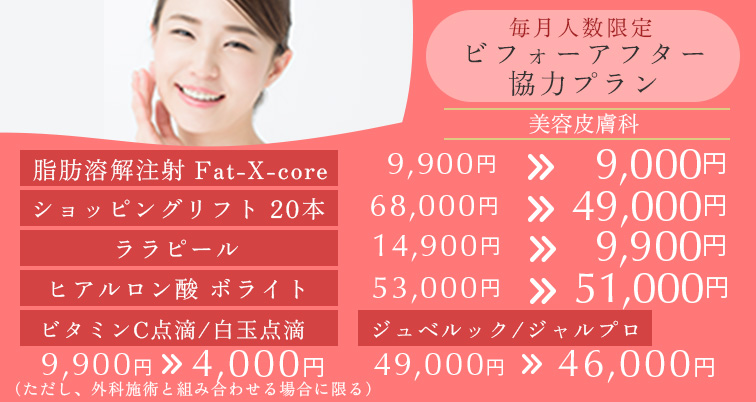 毎月人数限定 ビフォーアフター協力プラン。脂肪溶解注射 Fat-X-core 9,900円→9,000円 ショッピングリフト20本 68,000円→49,000円 ララピール14,900円→9,900円 ヒアルロン酸ポライト53,000円→51,000円 ビタミンC点滴/白玉点滴 9,900円→4,000円 ジュベルック/ジャルプロ 46,000円