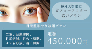 毎月人数限定 ビフォーアフター協力プラン。二重、目頭切開、目尻切開、目の上切開、タレ目形成、眉下切開 定額450,000円